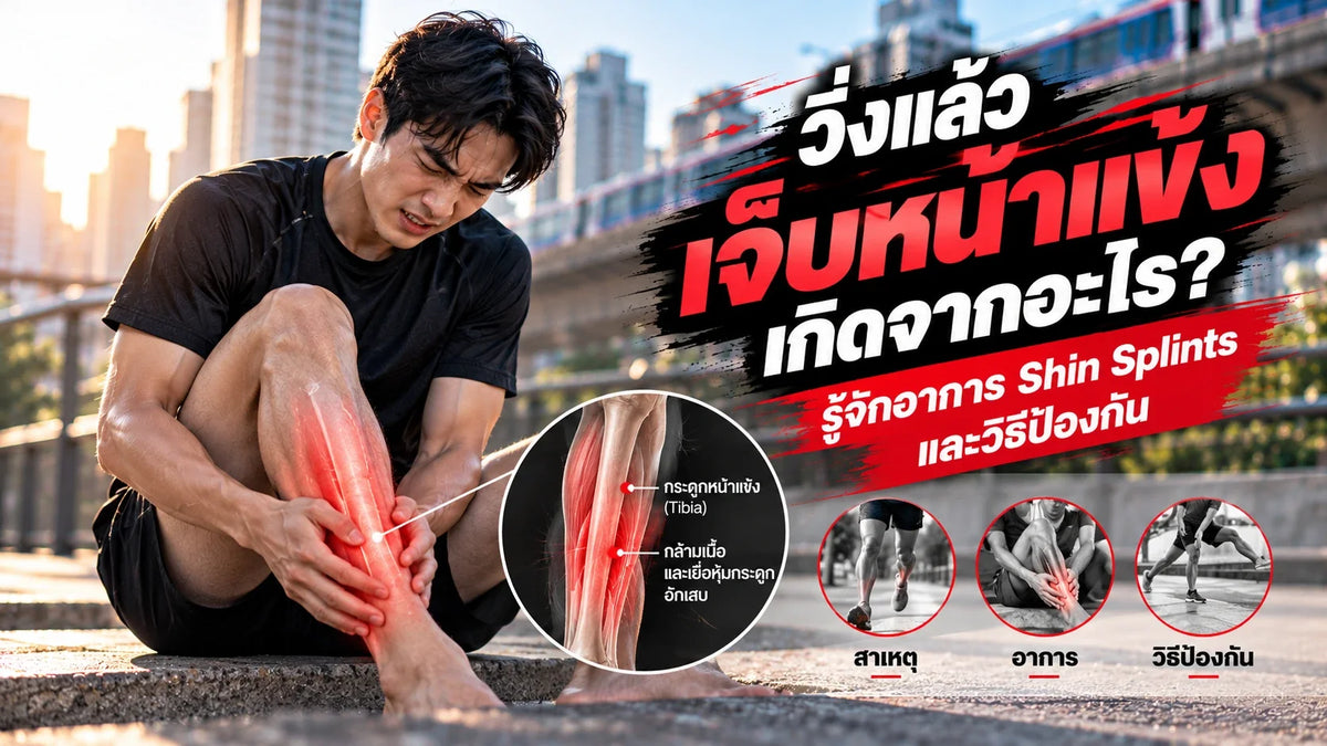 วิ่งแล้วเจ็บหน้าแข้งเกิดจากอะไร? รู้จักอาการ Shin Splints และวิธีป้องกัน
